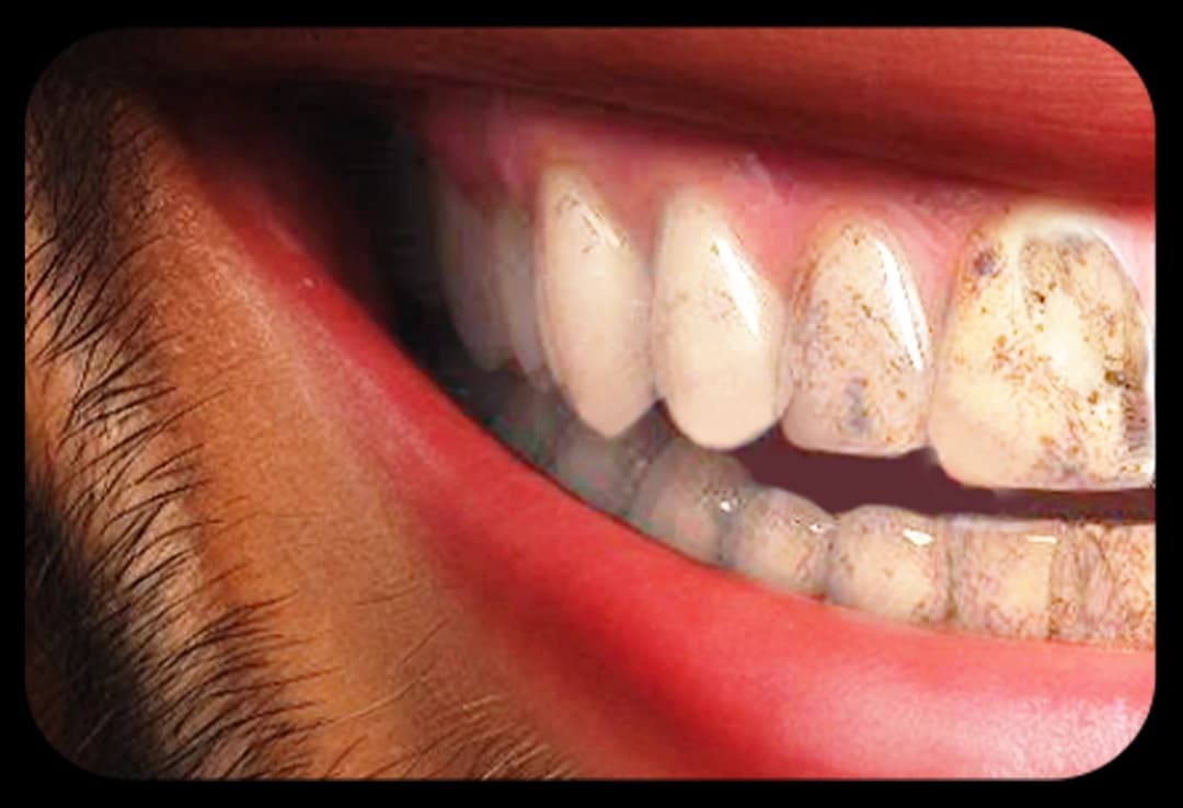 Before treatment